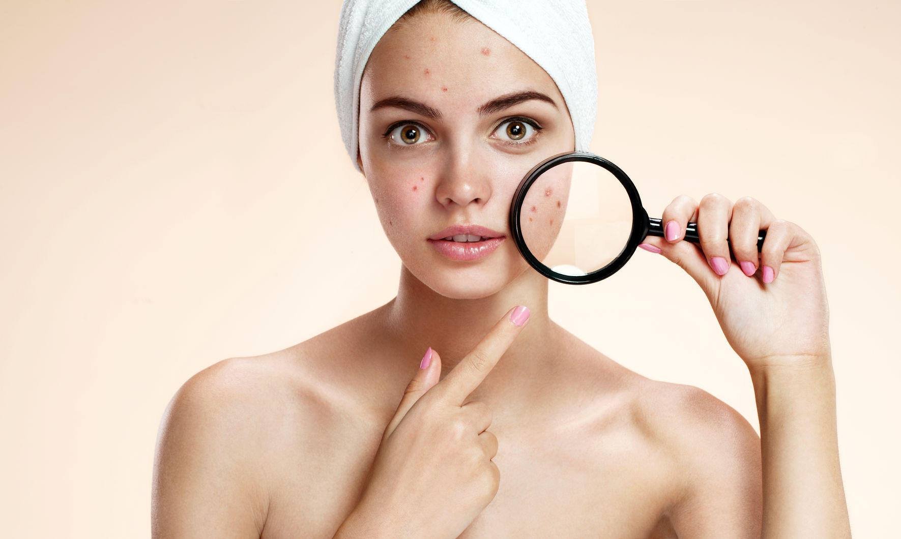 Skin Care Acne Scars Treatment