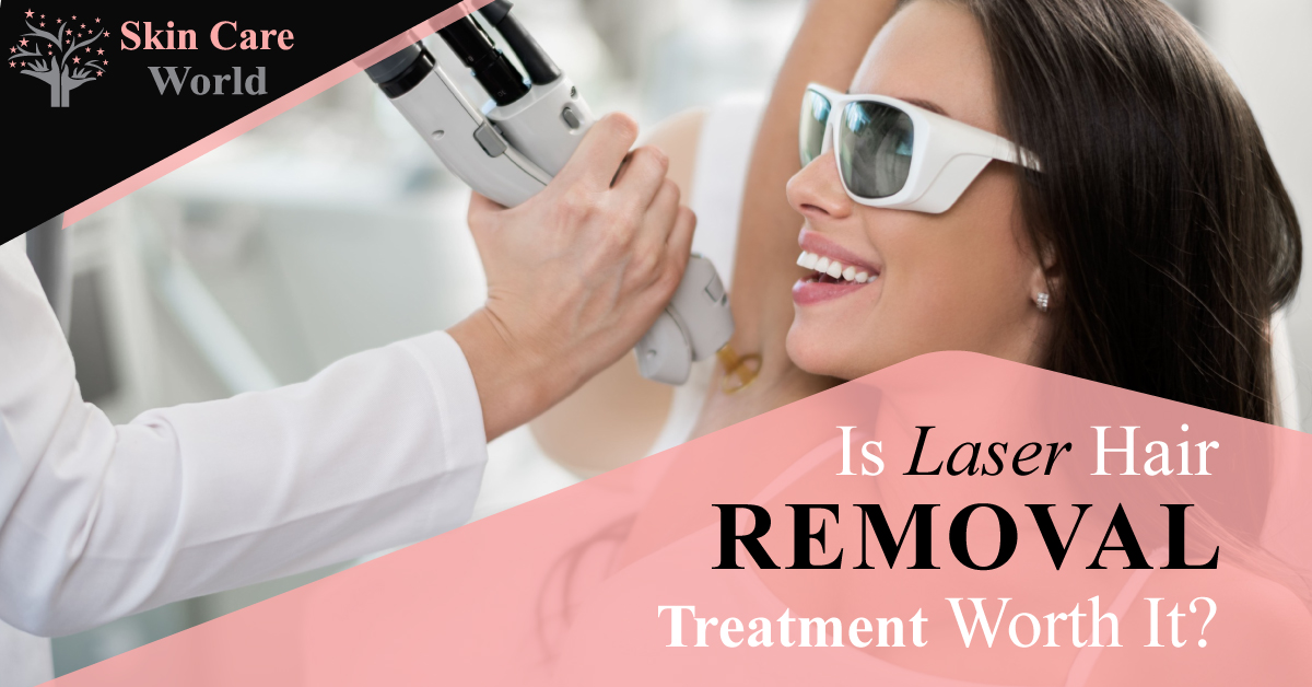 Is Laser Hair Removal Treatment Worth It?