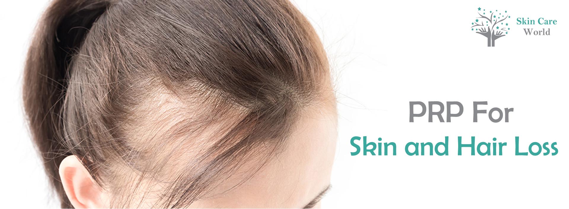 Skin & Hair Loss PRP Treatment Clinic in Gurgaon