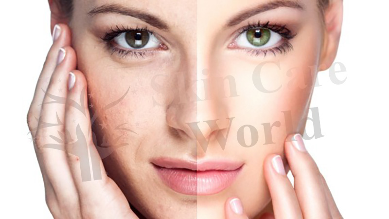 Face Skin Rejuvenation Treatment in Gurgaon