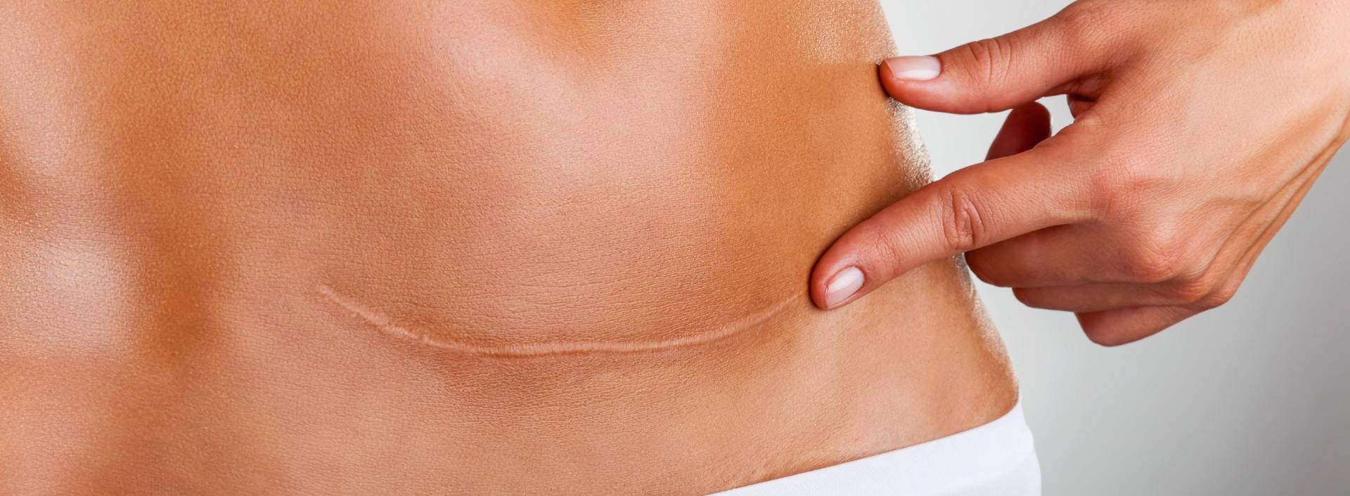 Skin & Body Scars Removal Treatment Clinic Gurgaon
