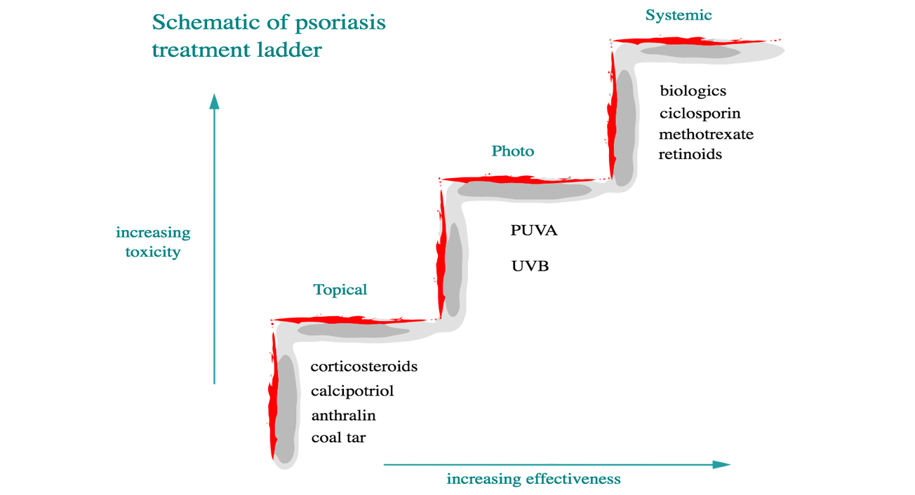 schematic of psoriasis treatment ladder